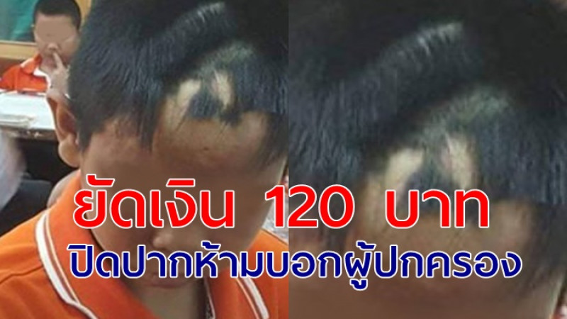  ครูขอนแก่นกล้อนผม เด็กชาย ม.1 แหว่งไปทั้งหัว   ก่อนยัดเงิน 120 บาท เพื่อปิดปากห้ามบอกผู้ปกครอง