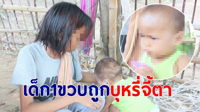 "แม่วัย19" รับไม่ได้ ลูกชาย 1 ขวบ ถูกเพื่อนสามีเอาบุหรี่จี้ดวงตา