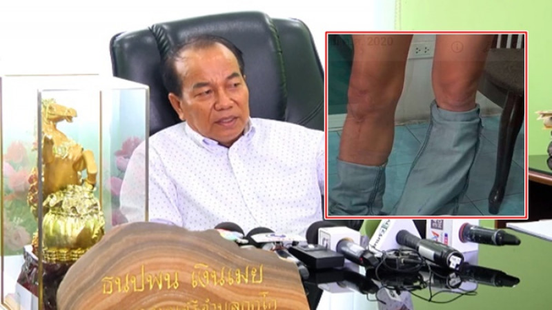 หลานชาย​ นายกเทศมนตรีลพบุรี แสดงความบริสุทธิ์ใจ ถกกางเกงโชว์ ยันไม่ได้ขาเป๋