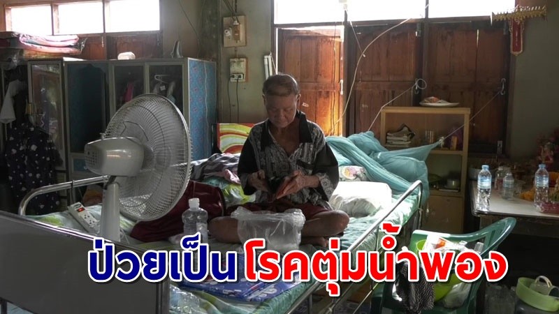 สุดสงสาร ! "สาวโคราช" ป่วยเป็นโรคตุ่มน้ำพอง ทรมานมานานกว่า 5 ปี