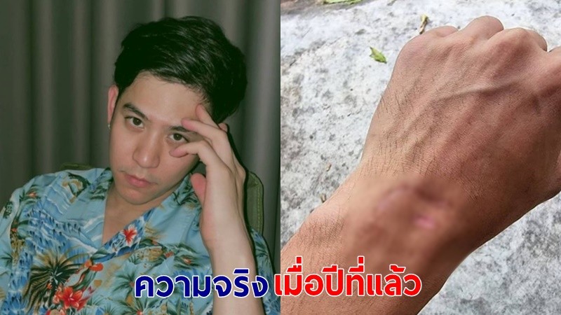 "พอร์ช ศรัณย์" เข้าแจ้งความคนใส่ร้าย เผยรอยแผลเป็น ลั่นผมลูกผู้ชาย ไม่เคยพูดลับหลัง