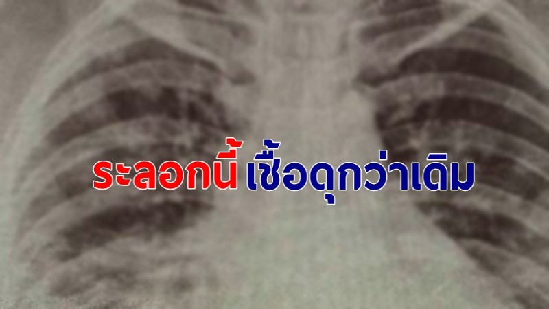 "หมอจุฬาฯ" เผยโควิด-19 รอบนี้เชื้อดุกว่าเดิม ! คนไข้อาการรุนแรงเร็ว สัปดาห์นี้จะเจอเคสห้อง ICU มากขึ้น