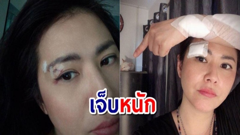 "น้ำผึ้ง" ได้แผล หลังเป็นกรรมการห้ามแมว ถึงขั้นเย็บ