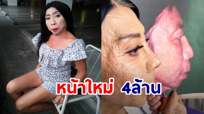 ป้าสิตางศุ์ ทำหน้าใหม่ 4 ล้าน เผยภาพให้ชมชัดๆ