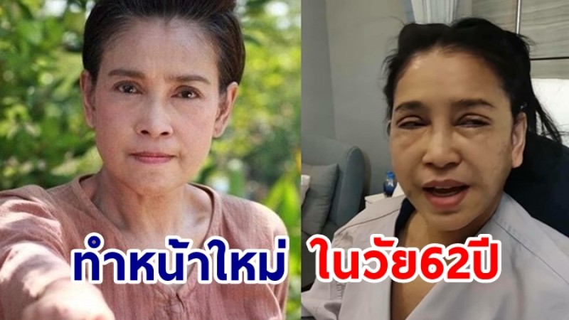 สุดปัง!  อำภา ภูษิต ขึ้นเขียงอัพหน้าเด็ก ในวัย วัย 62ปี