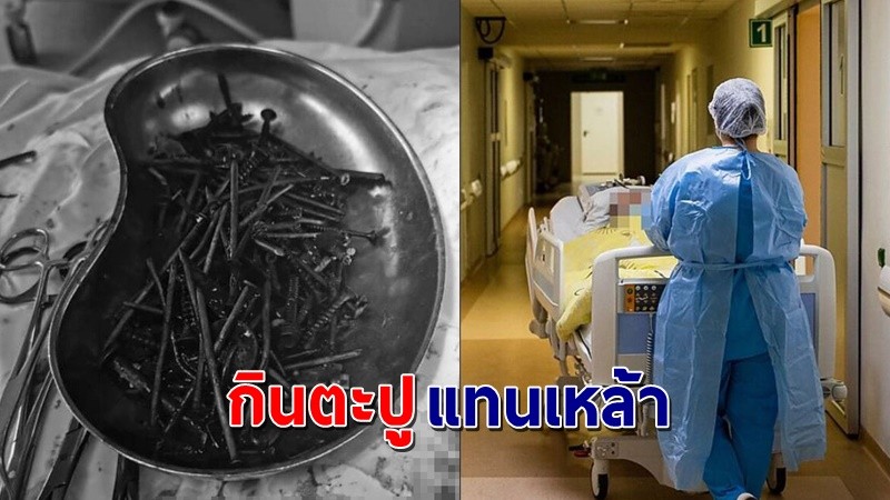 "แพทย์ผงะ"  พบชายหนุ่มปวดท้องหนัก เหตุกินเหล็ก - ตะปูแทนเหล้า ผ่าตัดด่วน !