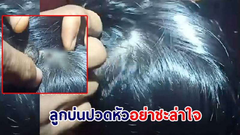 ขนลุกไปทั้งตัว ! ลูกชายบ่นปวดหัว เปิดดูผงะเจอ "เห็บ" ไซส์ใหญ่