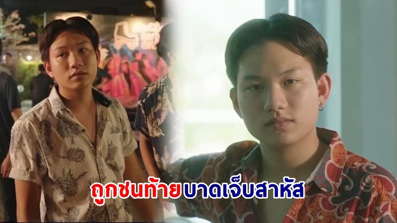 "อ็อฟ ธนกฤต" นักแสดงจากภาพยนตร์เรื่อง "16 ห้าว 19 เดือด" ถูกชนท้ายมอเตอร์ไซต์ บาดเจ็บสาหัส ต้องผ่าตัดสมอง