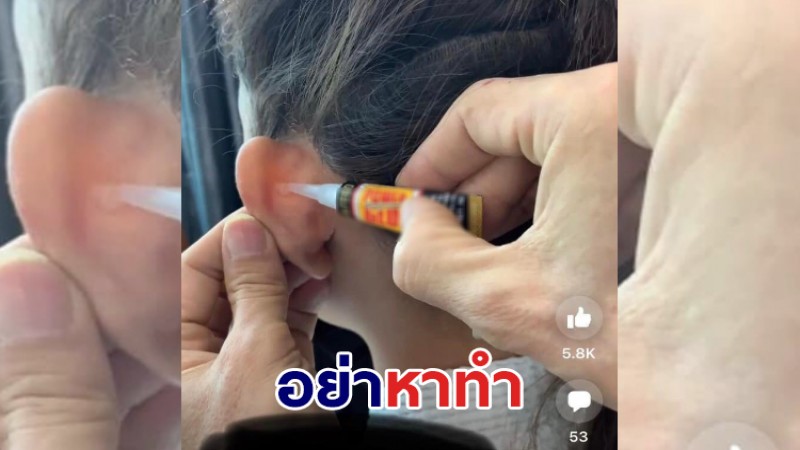 เพจดังเตือน วิธีแก้หูกางแบบใช้กาวตราช้าง อย่าหาทำ อันตรายมาก