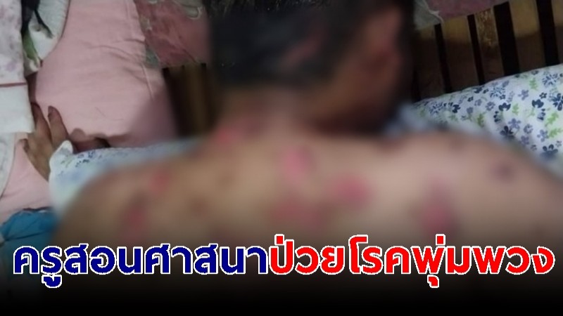 "ครูสอนศาสนา" เมืองคอน ป่วยโรคพุ่มพวง เผยรักษาหมดเป็นหมื่นไม่หาย-ทรุดหนัก