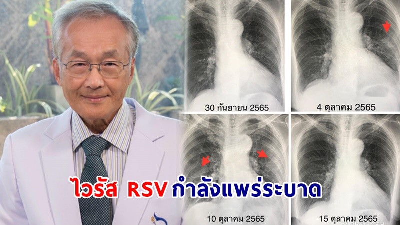 "หมอมนูญ" ​เตือน! ไวรัส RSV กำลังแพร่ระบาดในเด็กเล็ก - คนสูงอายุ ช่วงปลายฝนต้นหนาว