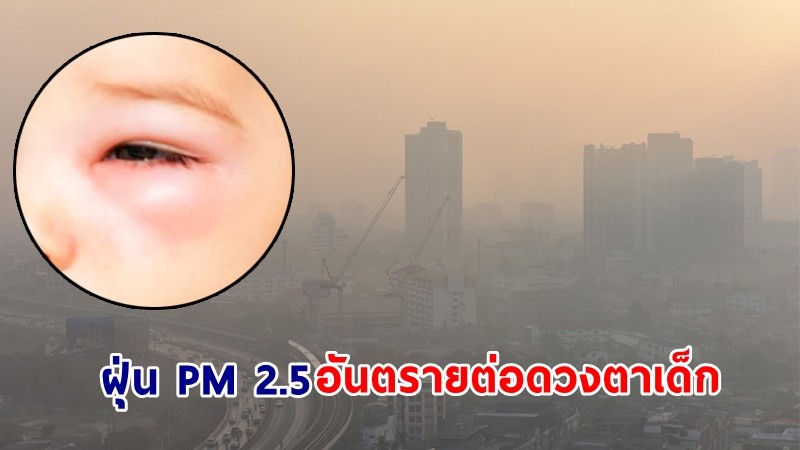แพทย์เตือน ! "ฝุ่น PM 2.5" อันตรายต่อดวงตาเด็ก รุนแรงถึงขั้นเยื่อบุตาอักเสบ