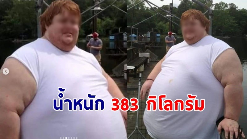 สุดทึ่ง ! ชายน้ำหนัก 383 กก. ผ่านไป 4 ปี ลดลงไปเหลือแค่ 113 กก. !