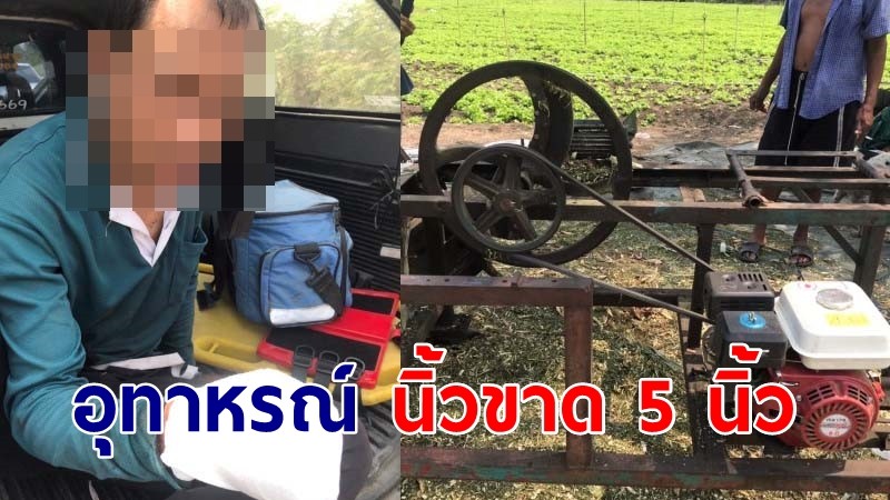 อุทาหรณ์! เครื่องโม่กระถินตัดนิ้วมือ หนุ่มวัย 33 บาดเจ็บสาหัส