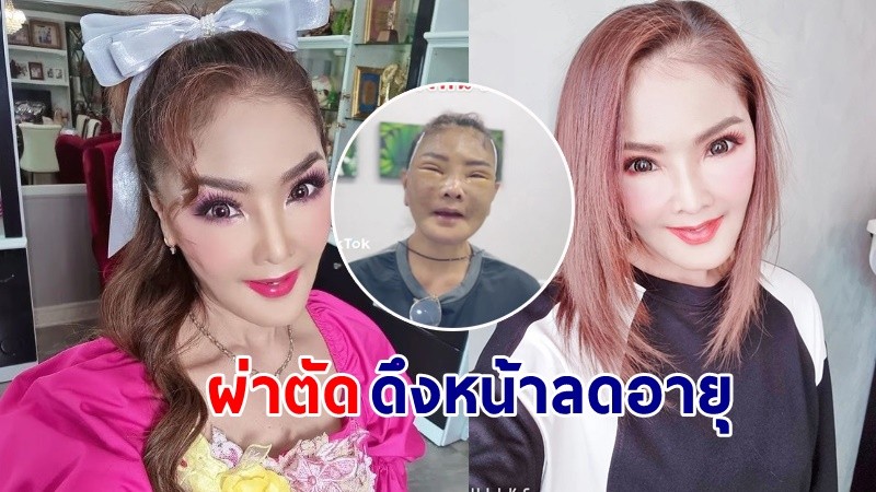 "ดาว มยุรี" เข้าผ่าตัดศัลยกรรมดึงหน้าลดอายุ ชาวเน็ตแห่เข้าไปส่องหน้าใหม่ !