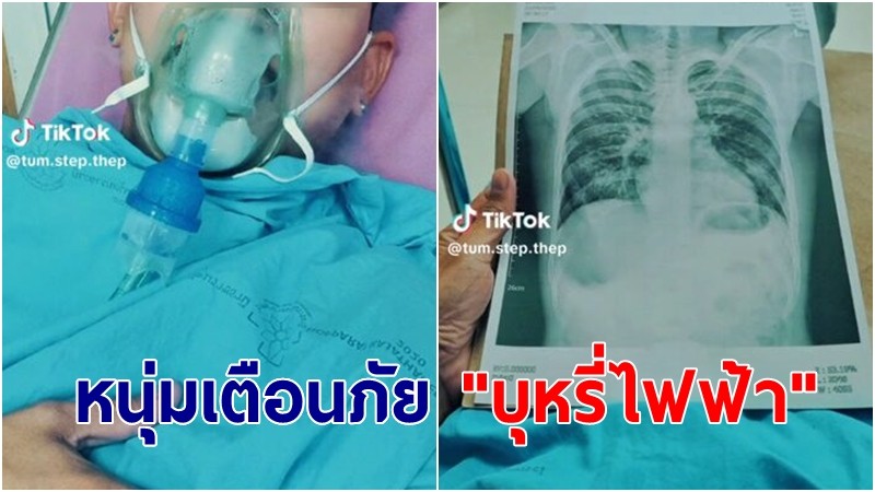 หนุ่มเตือนภัย "บุหรี่ไฟฟ้า" จากคนแข็งแรง ต้องใส่สายออกซิเจน สุดทรมาน