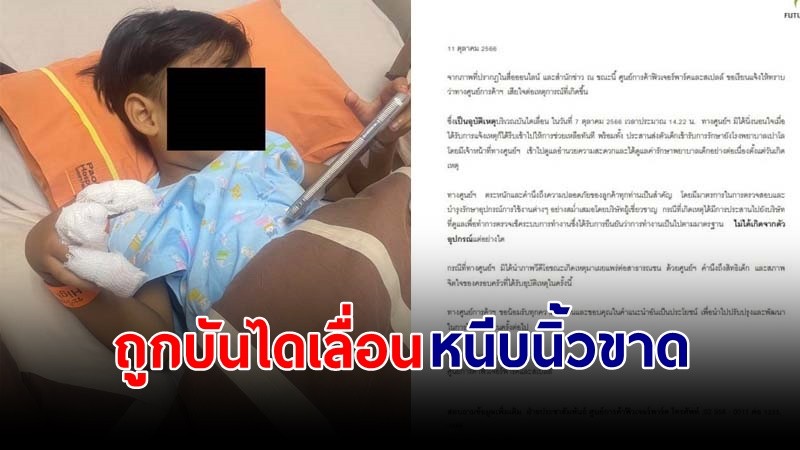 "ห้างฯดังชี้แจง" กรณีเด็ก 4 ขวบถูกบันไดเลื่อนหนีบนิ้วจนขาด !