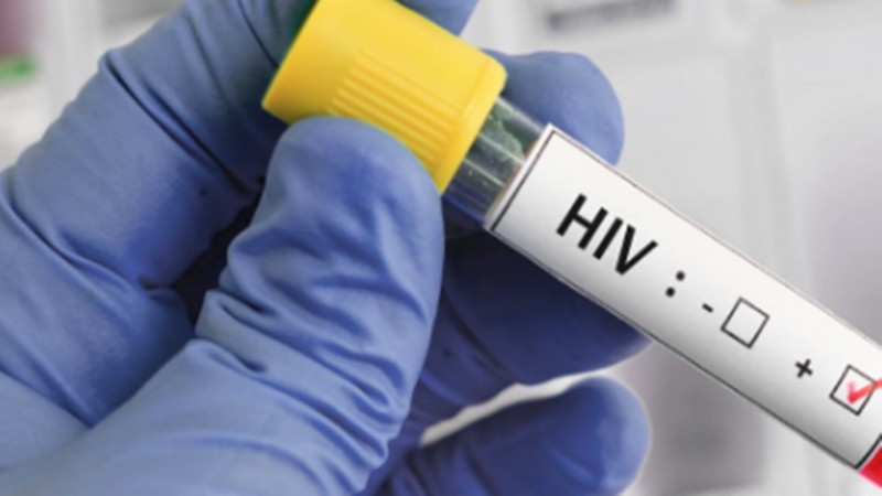 กรมอนามัย ห่วง วัยรุ่นติดเชื้อ HIV สูงขึ้น แนะ 4 แนวทาง "รักเป็น ปลอดภัย