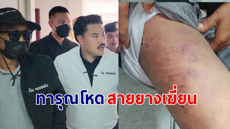 "กัน จอมพลัง" เข้าช่วยหนุ่มอายุ 38 ปี ถูกนายจ้างทารุณ ใช้สายยางเฆี่ยน !