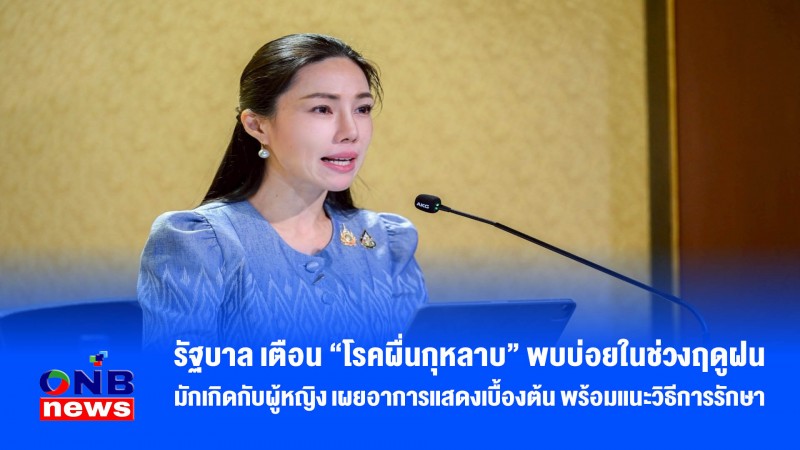 รัฐบาล เตือน “โรคผื่นกุหลาบ” พบบ่อยในช่วงฤดูฝน มักเกิดกับผู้หญิง เผยอาการแสดงเบื้องต้น พร้อมแนะวิธีการรักษา