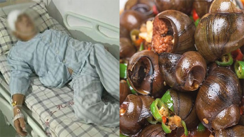 อุทาหรณ์สายหอย! ชายป่วยผิดปกติ รักษาตัวหาโรคนาน 10 ปี รู้ตัวอีกทีพยาธิกัดกินสมอง (ภาพ)