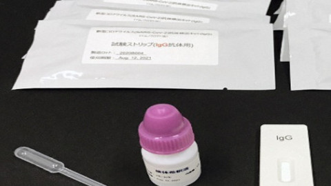 ญี่ปุ่นเตรียมจำหน่าย "ชุดทดสอบการติดเชื้อไวรัสโควิด-19" รู้ผลในเวลาเพียง 15 นาที