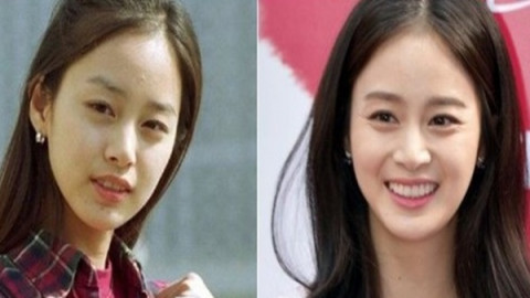 ส่องพัฒนาการ ดารานักแสดงเกาหลี จัดฟันทำหน้าเปลี่ยน 