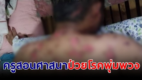 "ครูสอนศาสนา" เมืองคอน ป่วยโรคพุ่มพวง เผยรักษาหมดเป็นหมื่นไม่หาย-ทรุดหนัก