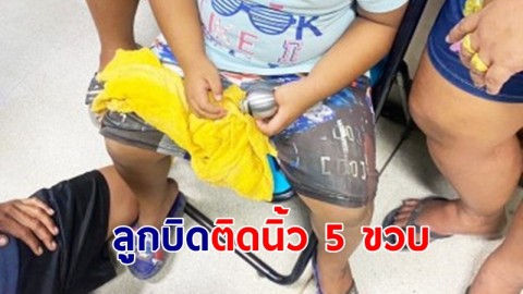 เตือนภัย 5 ขวบ เปิดประตูห้อง ลูกบิดหลุดติดนิ้ว แจ้งกู้ภัยช่วย