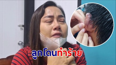 แม่ไลฟ์สดร่ำไห้! ลูกชายถูกเพื่อนทำร้ายรับน้องใหม่ หน้าช้ำหูเป็นหนอง ร.ร.บอกไม่มีอะไร