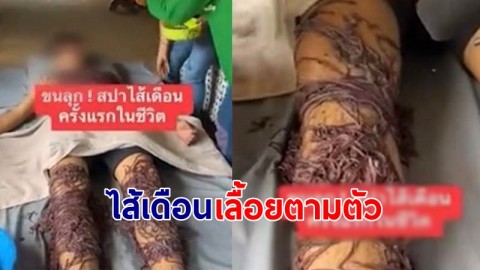 ขนลุก ! คลิปทำ "สปาไส้เดือน" เลื้อยตามตัว เชื่อทำให้ผ่อนคลาย !